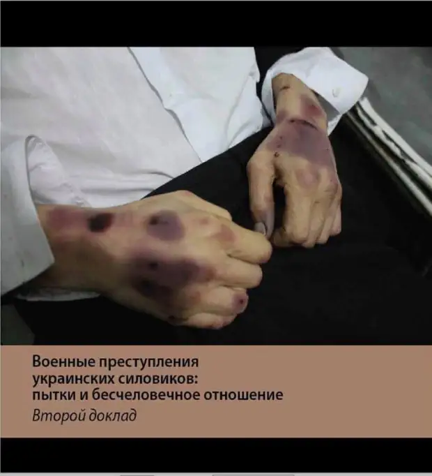 Фейк от ООН: Снимок замученного СБУ дончанина выдали за пытки белорусского ОМОНа